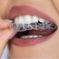 Aligners