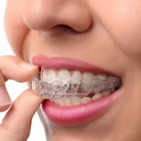 Clear Aligners