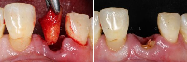 Cosmetic Dentistry