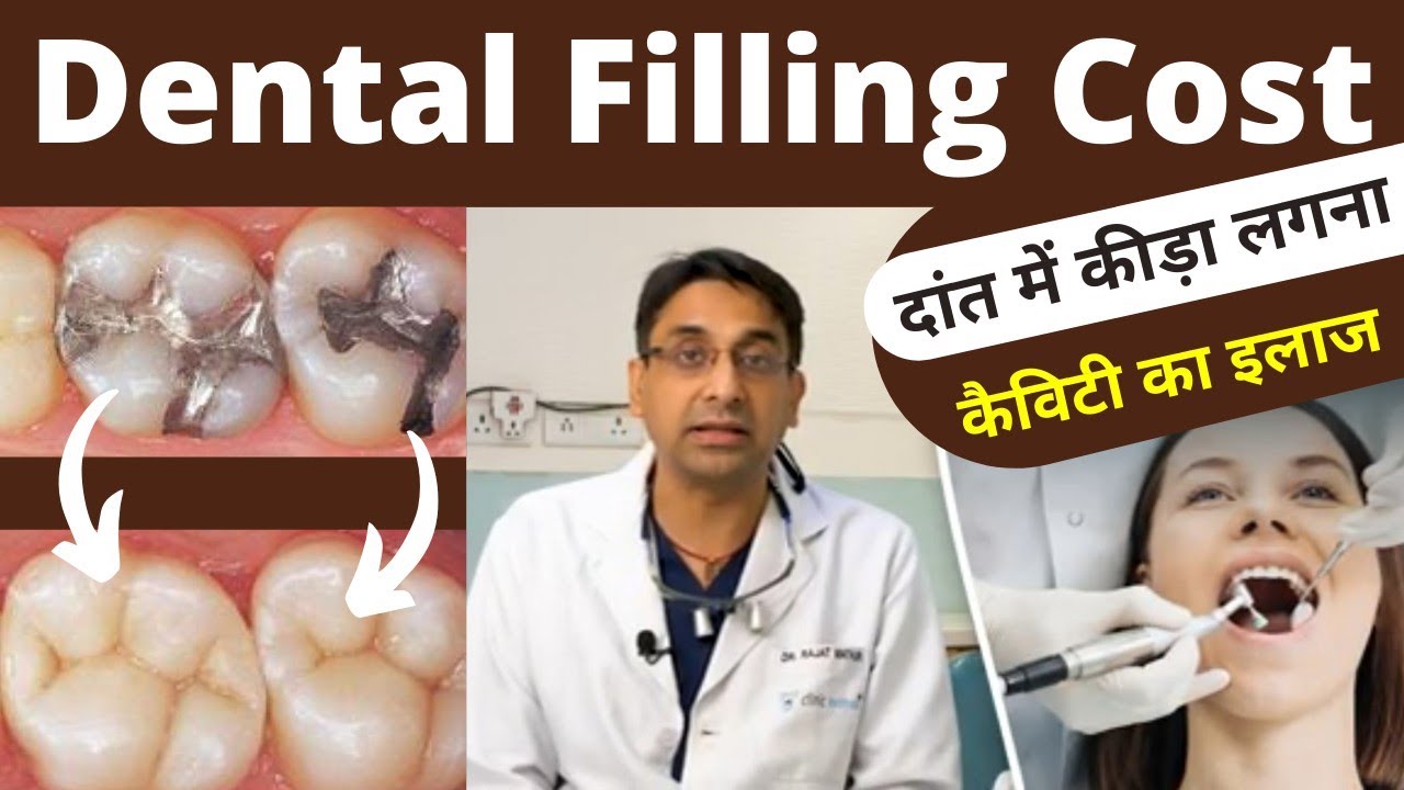 Dental Cavity Filling Procedure Treatment And Cost In Hindi