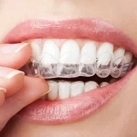 INVISALIGN dental
