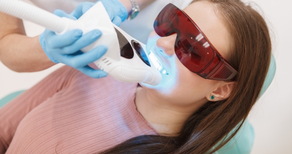 Laser teeth whitening