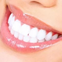 Tooth Whitening