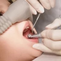 dental treatments